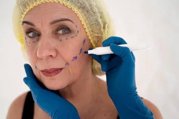 Certification in Plasma Lift (Fibroblast)