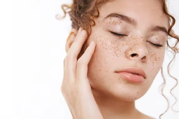 Freckle Removal