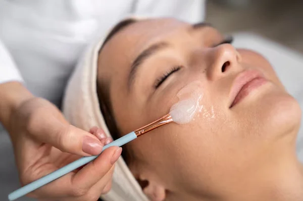 Chemical Peels