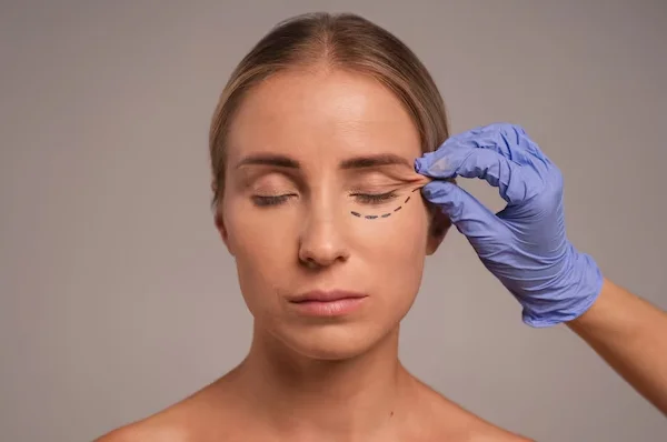 Undereye Filler