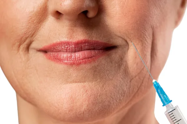 Fillers