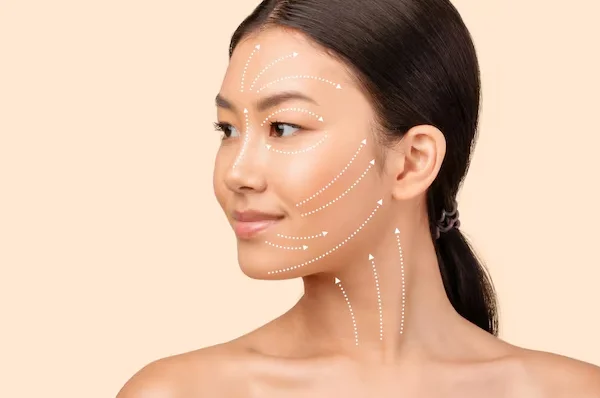Thread Lift